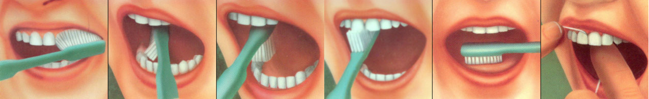 Как правильно чистить зубы? DENTEX, г.Новокузнецк